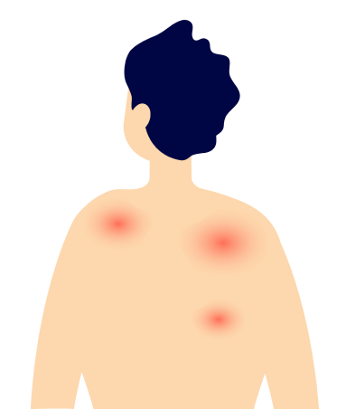 fop-flare-ups banner desktop